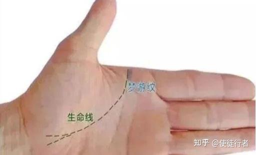 Palmistry drawing showing many fine vertical lines at the origin of the Life Line