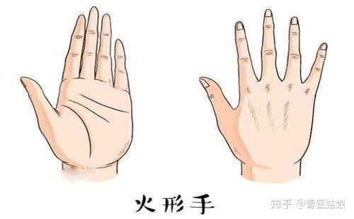 Fire hand shape example