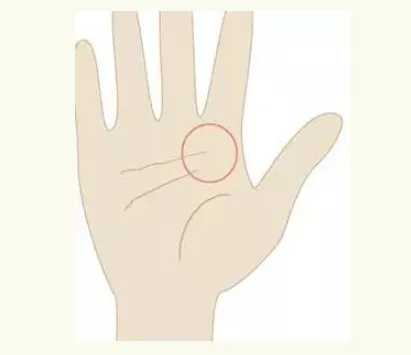 Cervical Spine Zone Palmistry